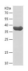    TARBP2 / Recombinant Human TARBP2