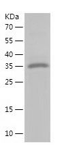    DIAPH1 / Recombinant Human DIAPH1