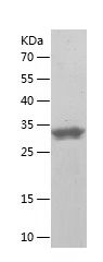    CIAO2B / Recombinant Human CIAO2B