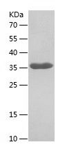    MARCKSL1 / Recombinant Human MARCKSL1