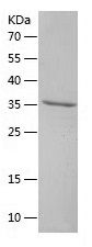    SULT1A1 / Recombinant Human SULT1A1