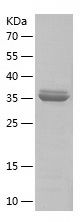    WNT1 / Recombinant Human WNT1