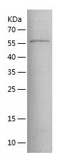    MDA5 / Recombinant Human MDA5