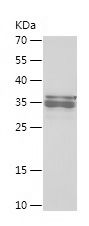    Histone H1.0 / Recombinant Human Histone H1.0