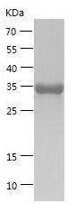    CXCL7 / Recombinant Human CXCL7