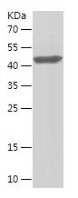    SLC12A2 / Recombinant Human SLC12A2