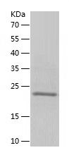    fgf21 / Recombinant Human fgf21