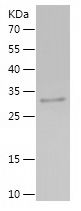 Recombinant Mouse Rantes