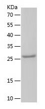    CSN2 / Recombinant Human CSN2