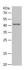    STBD1 / Recombinant Human STBD1