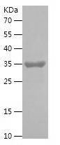    Syntaxin 6 / Recombinant Human Syntaxin 6