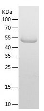    DDX21 / Recombinant Human DDX21