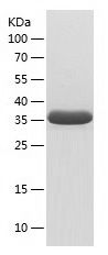 Recombinant Rat S100A9