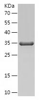 Recombinant Mouse S100A9