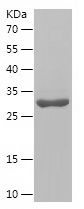 Recombinant Mouse S100A8