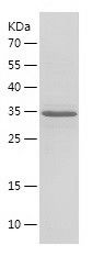 Recombinant Bovine S100a8