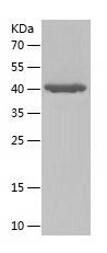    GPT2 / Recombinant Human GPT2