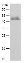    DLK1 / Recombinant Human DLK1