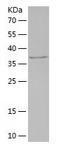    CARD9 / Recombinant Human CARD9