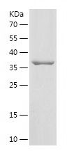    USP49 / Recombinant Human USP49