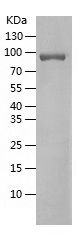    MMP-9 / Recombinant Human MMP-9