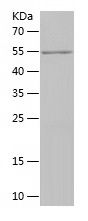    MMS19 / Recombinant Human MMS19