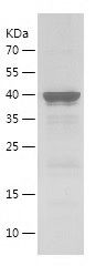    BIRC2 / Recombinant Human BIRC2