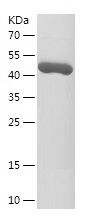    PHLPP1 / Recombinant Human PHLPP1