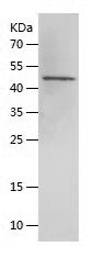    CYP51A1 / Recombinant Human CYP51A1