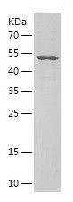    CNOT9 / Recombinant Human CNOT9