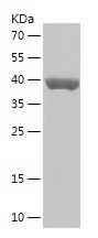    CYP27A1 / Recombinant Human CYP27A1