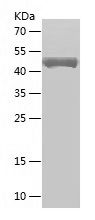    GSTM3 / Recombinant Human GSTM3