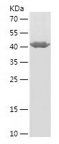    CCPG1 / Recombinant Human CCPG1