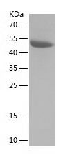    ETFB / Recombinant Human ETFB