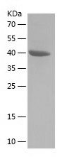    SLC3A2 / Recombinant Human SLC3A2