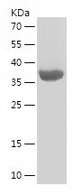    CES1 / Recombinant Human CES1