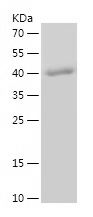    GPD2 / Recombinant Human GPD2