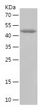    EIF2B4 / Recombinant Human EIF2B4