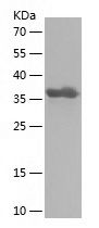    CHD1 / Recombinant Human CHD1