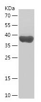    GLI3 / Recombinant Human GLI3