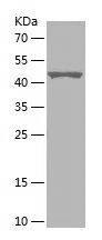    FBXW11 / Recombinant Human FBXW11