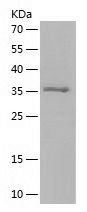    COTL1 / Recombinant Human COTL1