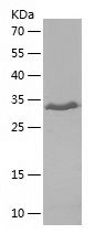    DRD5 / Recombinant Human DRD5