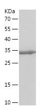    COX6B1 / Recombinant Human COX6B1