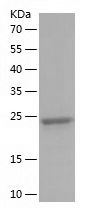    TAGLN2 / Recombinant Human TAGLN2