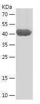    FKBP10 / Recombinant Human FKBP10