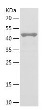    ARL6 / Recombinant Human ARL6