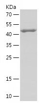    DHX9 / Recombinant Human DHX9