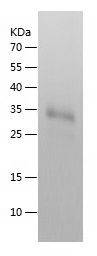    EMMPRIN / Recombinant Human EMMPRIN