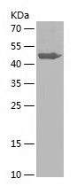    SULT4A1 / Recombinant Human SULT4A1